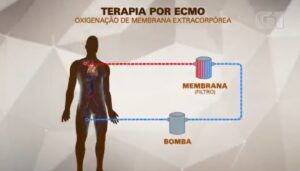 MC Marcinho é tratado com pulmão artificial após parada cardiorrespiratória