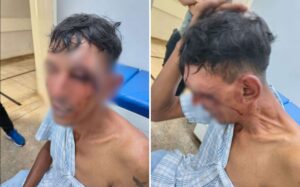Cinco guardas municipais viram réus por tortura e sequestro após invasão ilegal em Goiás